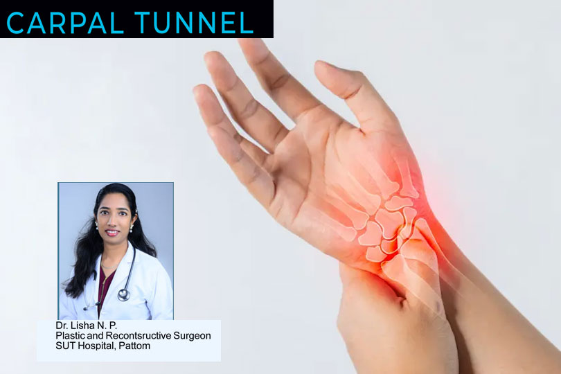 CARPAL TUNNEL SYNDROME